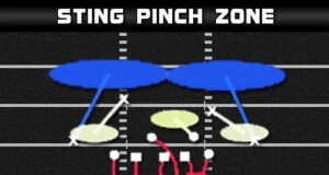 3 4 over sting pinch zone 1