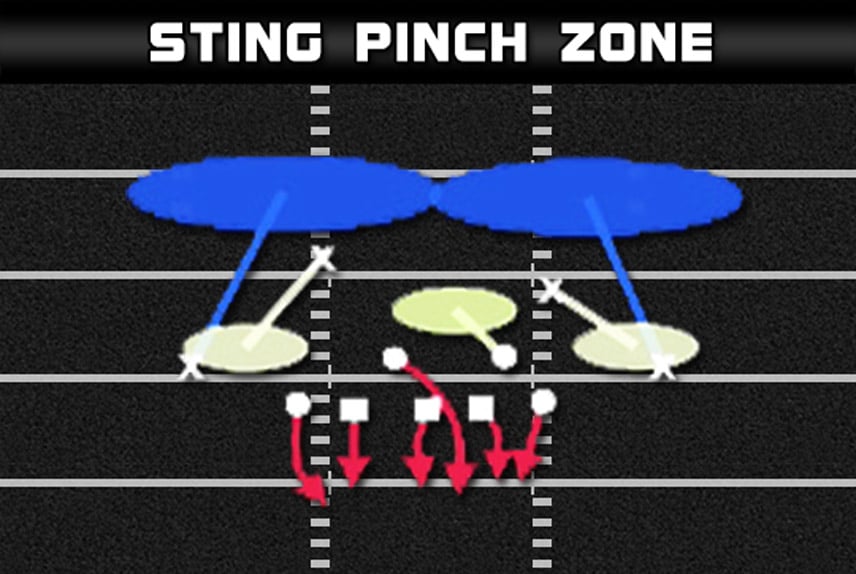 3 4 over sting pinch zone